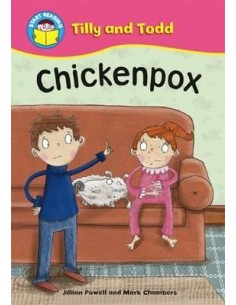 Chickenpox